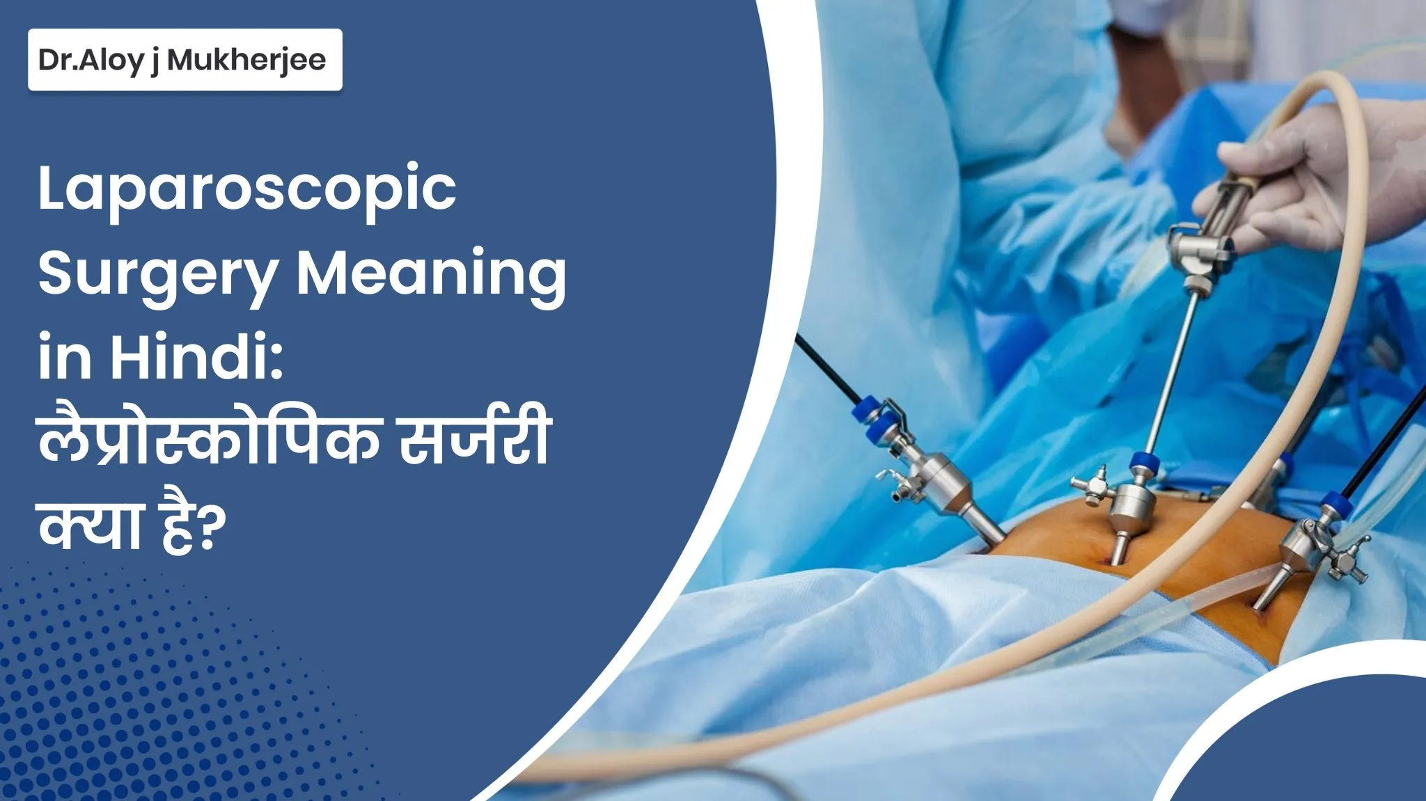 लैप्रोस्कोपिक सर्जरी: Laparoscopic In Hindi Meaning, प्रक्रिया, फायदे और जोखिम की विस्तृत जानकारी