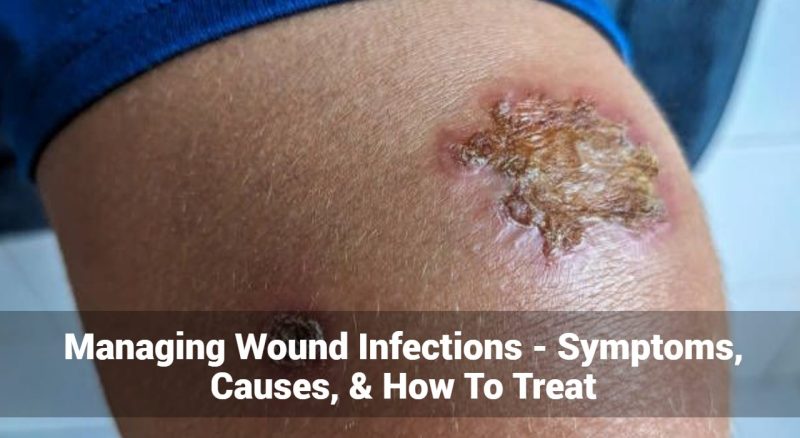 घायल होने के कारण और परिणाम (Causes and Consequences of Being Wounded): एक विश्लेषण